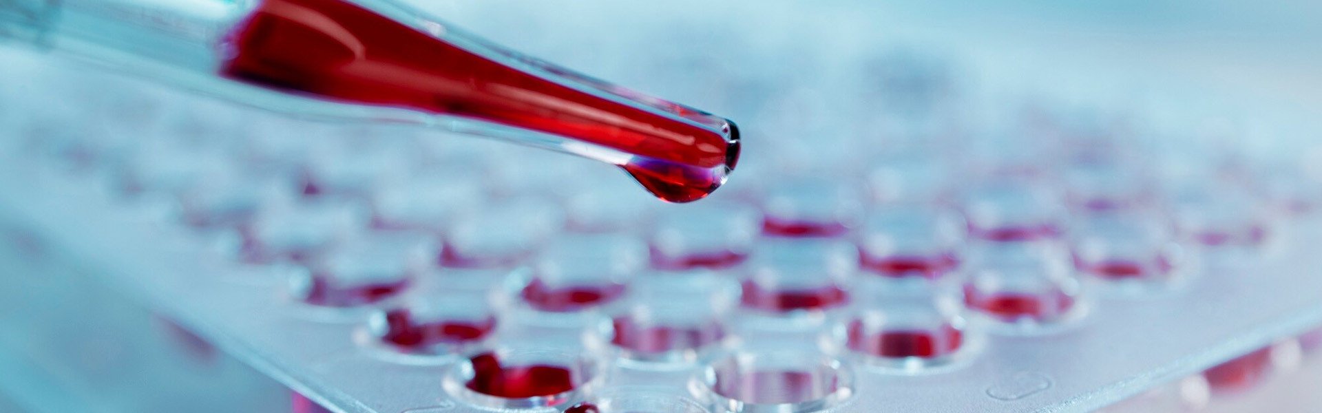 Oddělení klinické biochemie a hematologie