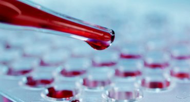 Oddělení klinické biochemie a hematologie