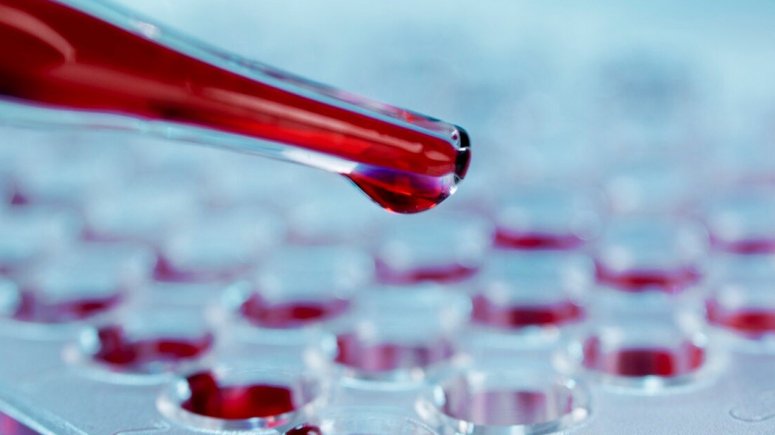 Klinická biochemie a hematologie