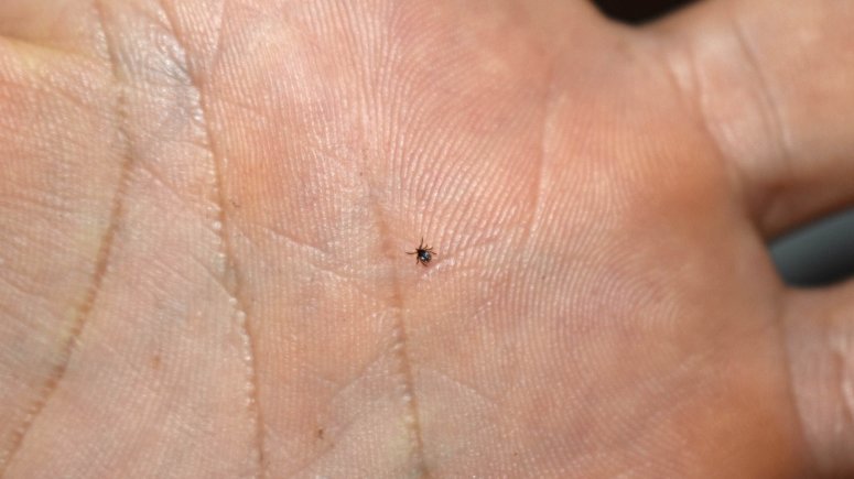 Infekční ambulance očkování encefalitida