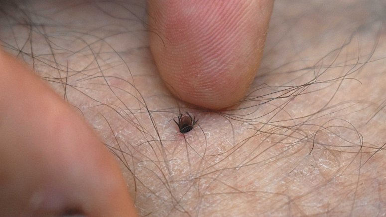 Výzva pacienta encefalitida